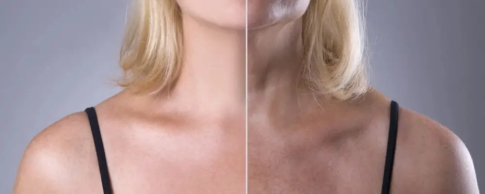 Estetik Dermatoloji